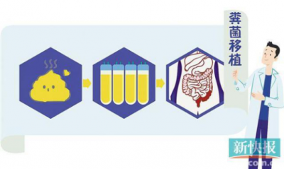奇招！“粪菌移植” 救了溃疡性结肠炎患者